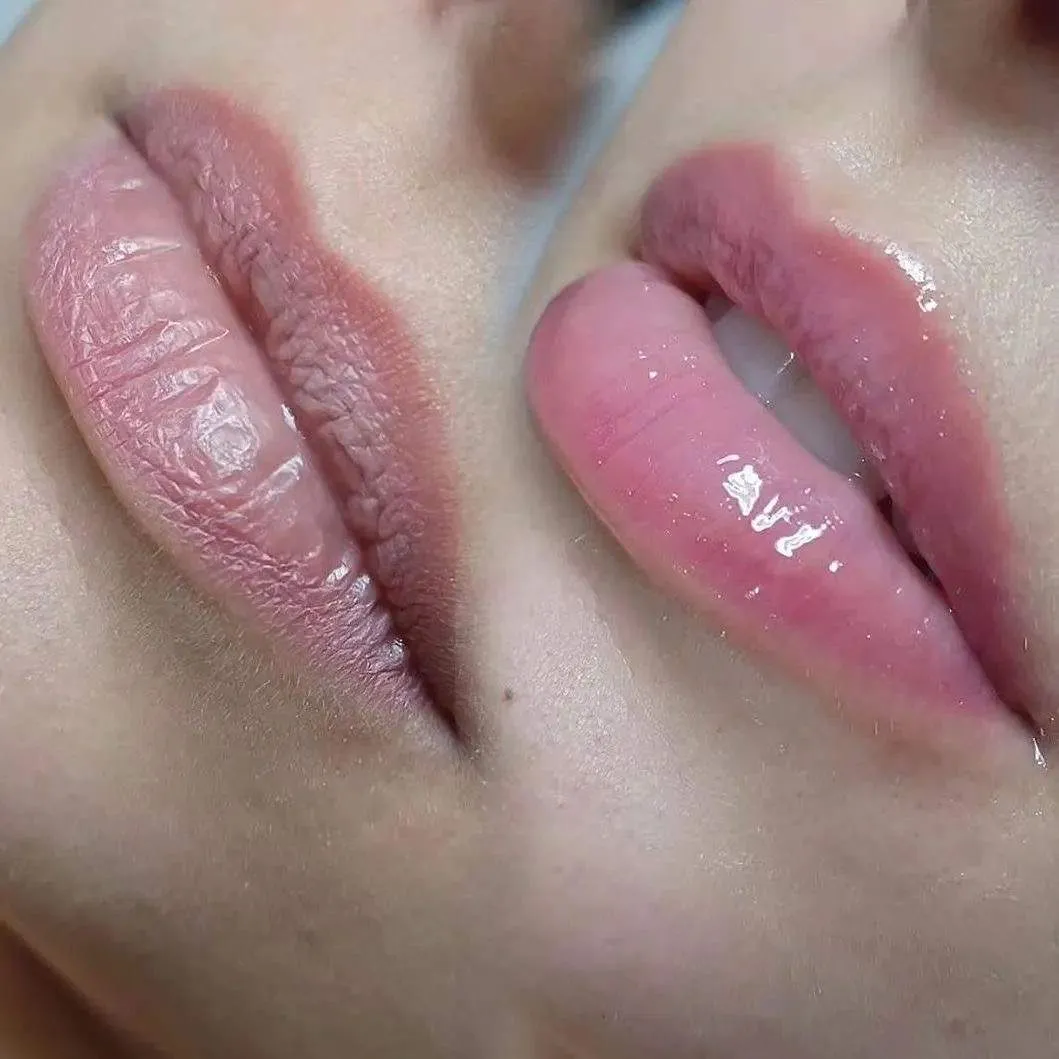 HYDRA  LIPS