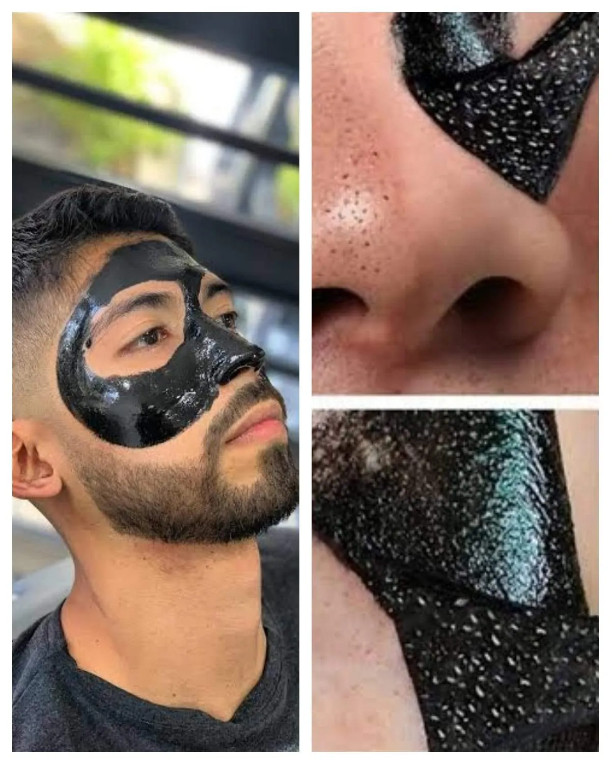 Limpieza Facial con BLACK MASK