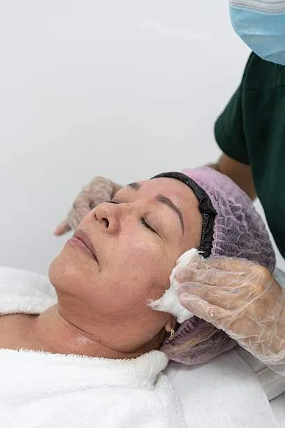 Limpieza facial profunda