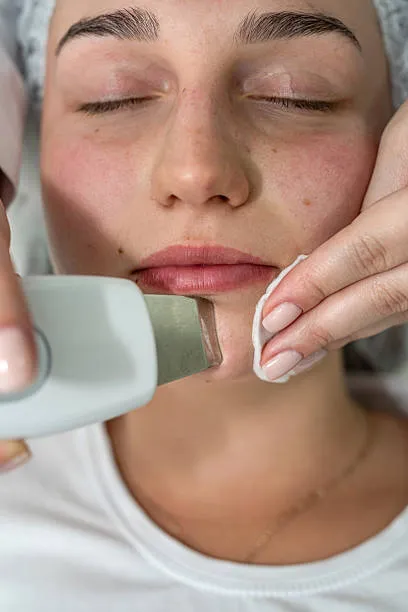 Sesión Espátula Ultrasónica